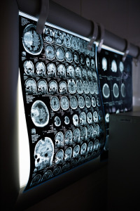 brain mri scan